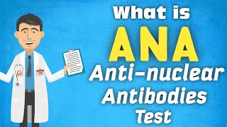 ANA TestAnti Nuclear Antibodies kiya hota hai in HindiUrdu Result Interpretation Rheumatology [upl. by Cirillo]