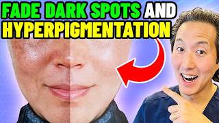 Plastic Surgeon Reveals 5 Ways to Get Rid of Hyperpigmentation Melasma and Spots [upl. by Anhoj987]