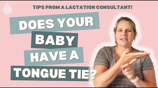 Does my baby have a TONGUE TIE Here’s how to tell [upl. by Aicercul637]