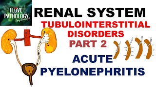 ACUTE PYELONEPHRITIS Pathology [upl. by Kisor604]