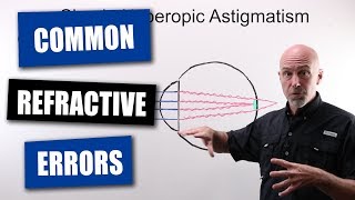 Common Refractive Errors Of The Human Eye [upl. by Tine]