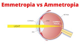 Emmetropia vs Ammetropia [upl. by Nwonknu]