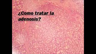 ¿Como tratar la adenosis Salud para la gente de mi tierra [upl. by Therine]