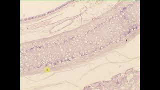 Hyaline Cartilage Trachea [upl. by Dorina15]