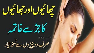 Chaiyon Ka Ilaj In urdu  Black Spots Treatment  Freckles Homeremedy In Urdu [upl. by Eibbed415]