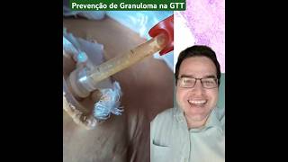 Prevenção de granuloma na gastrostomia gtt granuloma Gastrostomia cuidador linknabio [upl. by Esinaej]