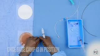 Route 92 Medical Monopoint System Handson Video [upl. by Ashling]