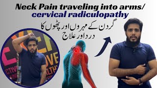 Pinched nerve in neck  C4C5C6 Cervical Radiculopathy  physical therapy treatment [upl. by Leiad213]