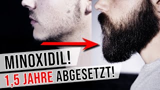 Ich habe Minoxidil für den Bart schon 15 Jahre abgesetzt  Bartwuchs Info Check [upl. by Yraeht]