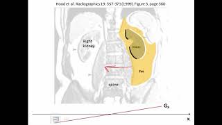 MRI Basics Chemical Shift JA6 Fig3 M12 [upl. by Adalia198]