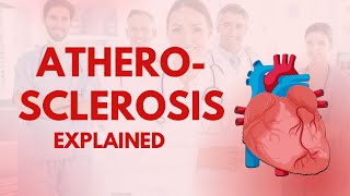 Atherosclerosis Explained [upl. by Humble]