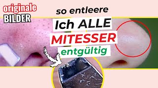 🚫👃 Mit dieser Methode Mitesser KOMPLETT entfernen  Einfacher gehts nicht  Mitesser loswerden [upl. by Asille757]