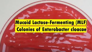 Characterizing Mucoid LactoseFermenting Colonies of Enterobacter cloacae [upl. by Rotkiv47]