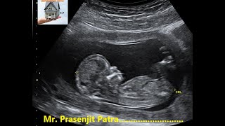 How To Do Fetal Biometry [upl. by Hajar509]