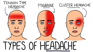 Primary v Secondary Headache with Red Flags  Tension Type Headache Migraine amp Cluster Headache [upl. by Goto71]