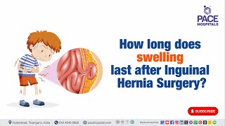 How long does swelling last after Inguinal Hernia Surgery  InguinalHerniaSurgery [upl. by Branen477]