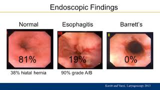 Practical Approach to Management of Extraesophageal GERD [upl. by Ira]