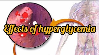 Hyperglycemia medical medicalstudent mediconeet mbbs bds physiology biologyboost [upl. by Akinahs]