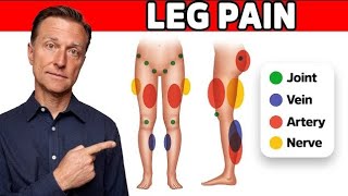 How to relief from leg pain viralvideos videofeed shortsfeed trending trendingvideo medicine [upl. by Teevens131]