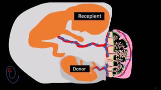 Twin to twin transfusion syndrome TTTS   part 1 pathogenesis [upl. by Kitrak]