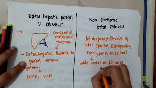 non cirrhotic portal hypertension  Hepatobiliary System [upl. by Nurat518]