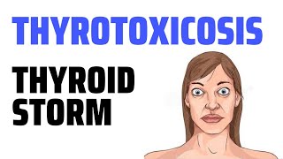 Thyrotoxicosis  Thyroid storm [upl. by Aiuqenehs]