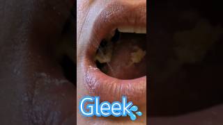 Gleek mouthsounds gleek [upl. by Jenette566]