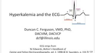 Hyperkalemia and the ECG [upl. by Ayekel]