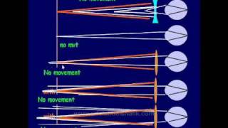 Optics  Retinoscopy Part One in Arabic [upl. by Aihk]