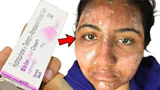 Safe skin lightening creams how to reduce dark spots  best fairness creams  dermatologist [upl. by Lyrrad]