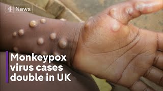 Monkeypox 11 new cases confirmed in UK [upl. by Bernhard]