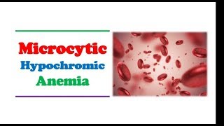 Hematology 🔤  Microcytic Hypochromic Anemia [upl. by Derrej]