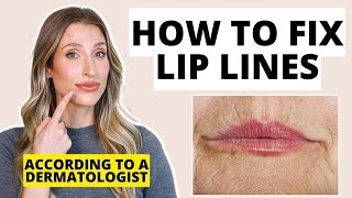 How to Fix Lip Lines  Dermatologist Shares Treatments for Lip Wrinkles [upl. by Thorncombe]