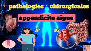 cours S3  Pathologies Chirurgicales et SI  appendicite aigue 💊🩺💉🩸 شرح سهل 📚و 📚 مبسط للفهم [upl. by Brion]