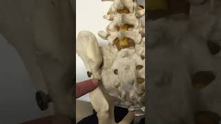 Rhizotomy of the SacroIliac Joint [upl. by Ahsielat]