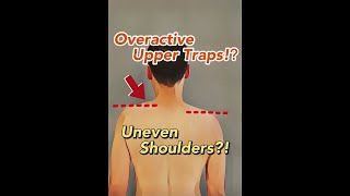 My Shoulders are Uneven Lets talk about the Upper Traps [upl. by Mcquade]