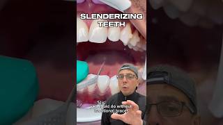 How Invisalign Can Fix Minimal Crowding of Teeth  View Mobile Dental shorts [upl. by Aramen]