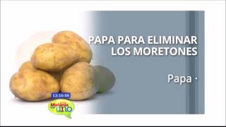 Papa para eliminar moretones [upl. by Nevets]