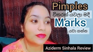 🦋 Azelaic Acid  Aziderm Sinhala Honest Review 🦋 [upl. by Ateuqram]