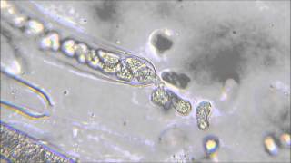 Oomycota zoospores being released from sporangia [upl. by Cormier575]