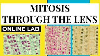 CELL DIVISION THROUGH THE LENS  USING MICROSCOPE TO SEE MITOSIS  ONLINE LAB  CELL DIVISION [upl. by Gilleod963]