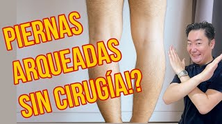 ¡Corrección de piernas arqueadas fácil y en casa Además para postura rodilla y pelvis [upl. by Bruis]