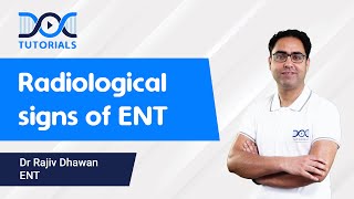 Radiological Signs of ENT  Dr Rajiv Dhawan  NEET PG amp FMGE  DocTutorials [upl. by Hawger]