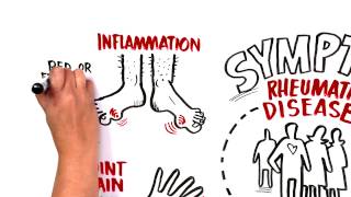 When Should I see a Rheumatologist [upl. by Mcnamara]