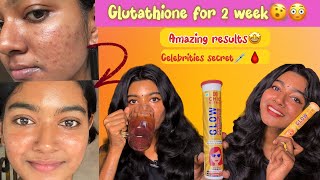 Glutathione ഇത്രയും റിസൾട്ട്‌ തരുമെന്ന് പ്രതീക്ഷിച്ചില്ല 😳💯🙌 2 week experience 🤩🌟 [upl. by Ynetruoc18]