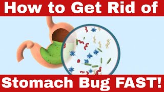 Banish Your Stomach Bug Fast How to Get Rid of Stomach Bug Today [upl. by Millda]