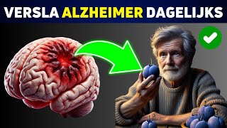 De 7 Beste Dagelijkse Gewoonten om Je Hersenen tegen Alzheimer te Beschermen [upl. by Jacqui767]