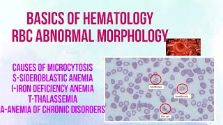 RBC MORPHOLOGY RBC MORPHOLOGICAL ABNORMALITIESRBC SIZESHAPE ABNORMAL MORPHOLOGYHEMATOLOGY [upl. by Bruyn36]