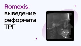 Возможности программы Romexis Viewer выведение реформата ТРГ [upl. by Whitney]