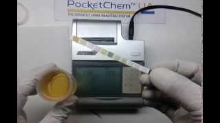 Pocket chem urine analyzer  ACR albumin creatinine ratio [upl. by Tamma]